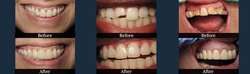 Before and after photos